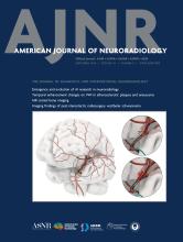 American Journal of Neuroradiology: 45 (9)