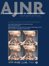 American Journal of Neuroradiology: 46 (4)