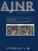 American Journal of Neuroradiology: 46 (5)