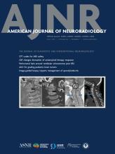 American Journal of Neuroradiology: 46 (7)